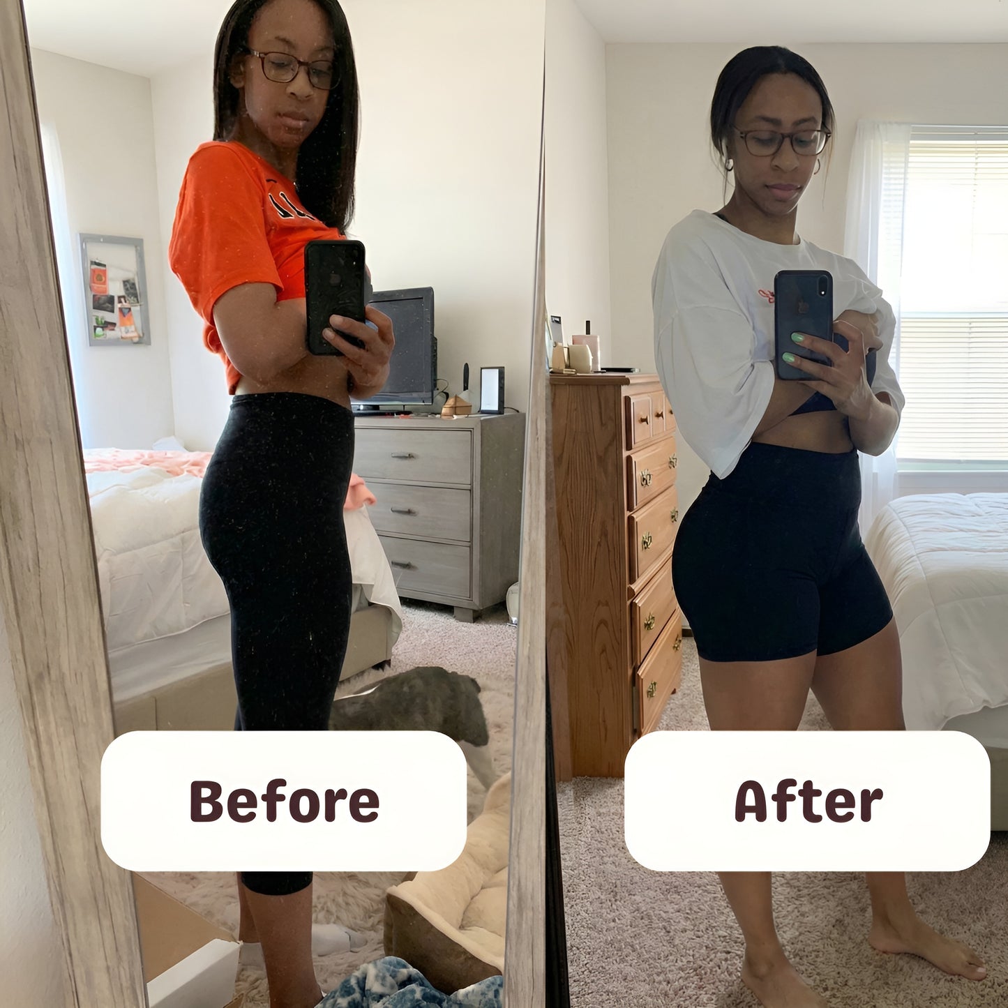 MYOFERA™ Curves Support Gummies