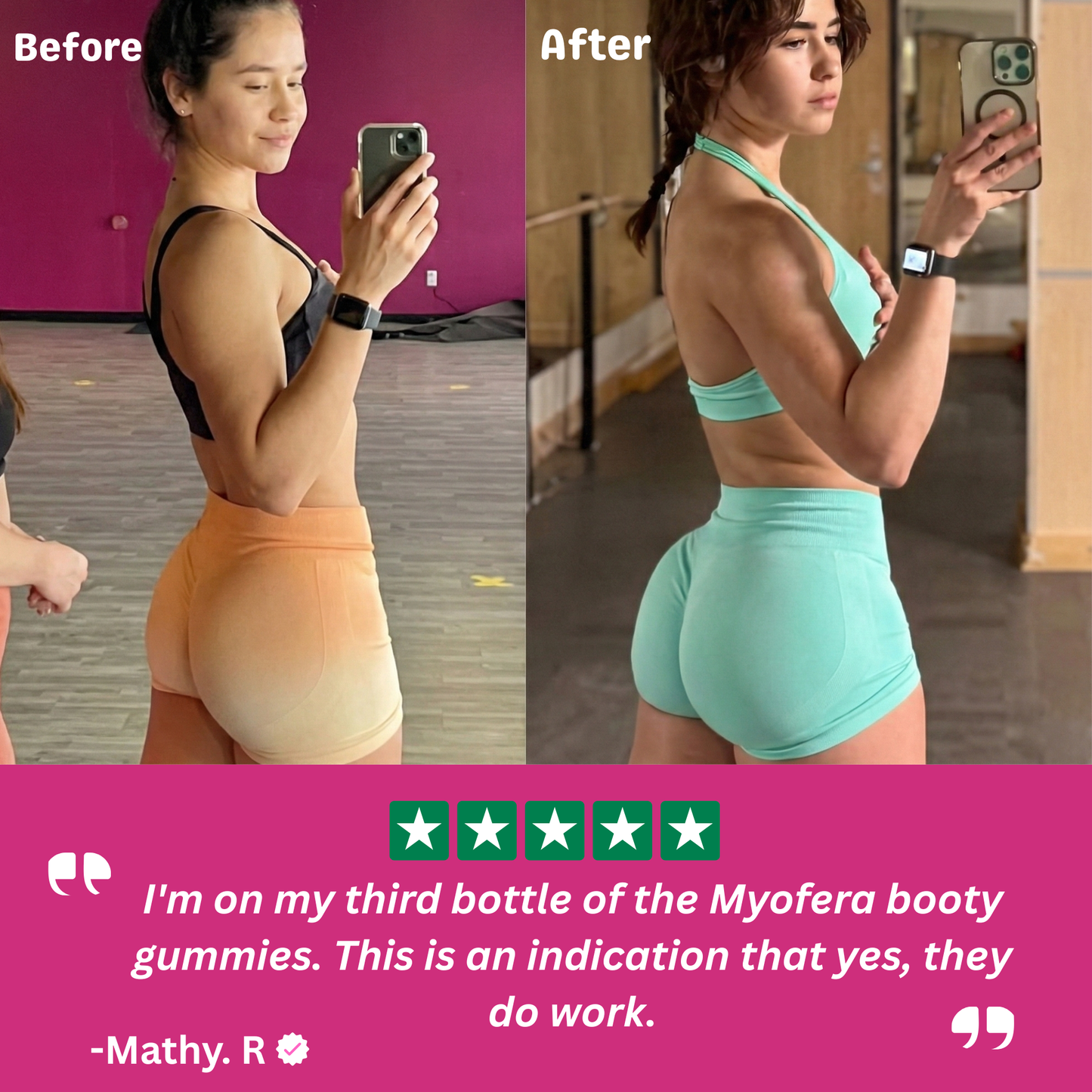 MYOFERA™ Curves Support Gummies