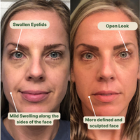 MyOfera™ Lymphatic Wellness Drops