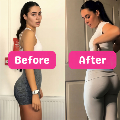 MYOFERA™ Curves Support Gummies